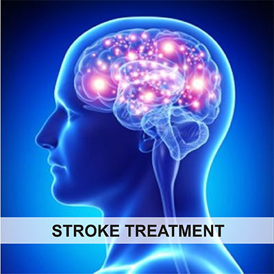 Stroke Treatment