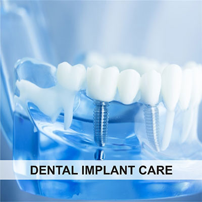 Dental Implant Care